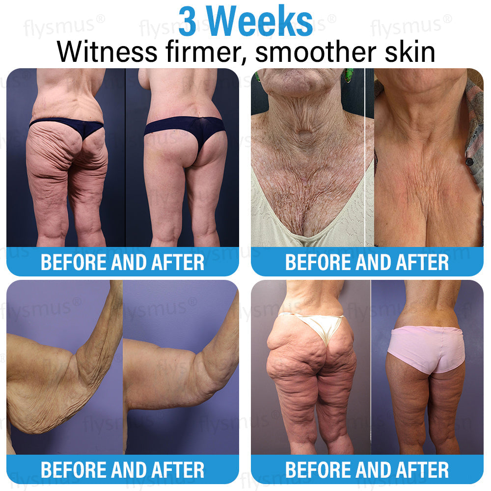 ✅ Made and Shipped from the USA | flysmus® Botox Repair Cream 🧑🏼⚕️ Anti-aging, Skin Repair, Acne and Dark Spot Treatment, Wart and Mole Removal, and Psoriasis Treatment