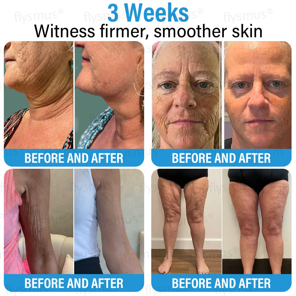 ✅ Made and Shipped from the USA | flysmus® Botox Repair Cream 🧑🏼⚕️ Anti-aging, Skin Repair, Acne and Dark Spot Treatment, Wart and Mole Removal, and Psoriasis Treatment