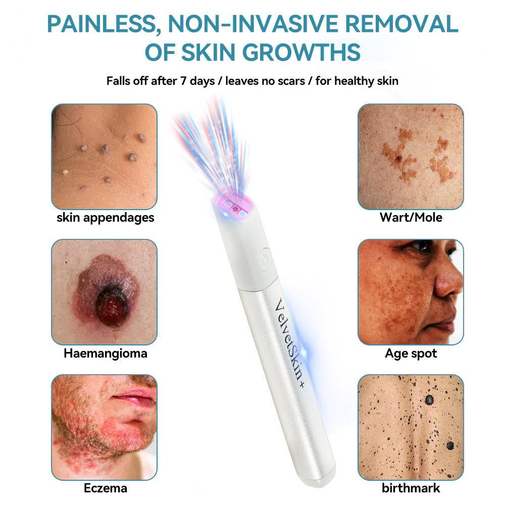 Bikenda® VelvetSkin+ Medical-Grade Laser Pen (Powered by CO₂ laser technology – effectively removes moles, warts, skin tags, pigmentation spots, and other skin imperfections)