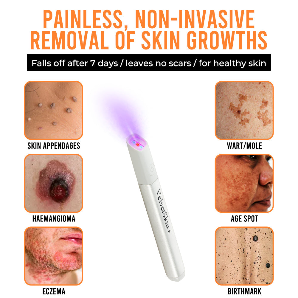 Remifa® VelvetSkin+ All-in-One Laser Eraser Pen (Powered by CO₂ laser technology – ef fectively removes moles, warts, skin tags, pigmentation spots, and other skin imperfections)