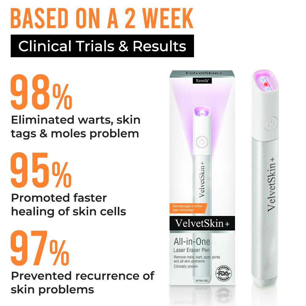 Remifa® VelvetSkin+ All-in-One Laser Eraser Pen (Powered by CO₂ laser technology – ef fectively removes moles, warts, skin tags, pigmentation spots, and other skin imperfections)